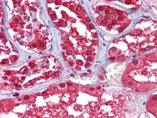 Anti-GPI antibody [1B7D7] used in IHC (Paraffin sections) (IHC-P). GTX83039