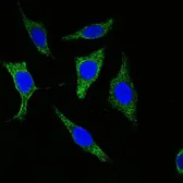 Anti-pan Cytokeratin antibody [7H8] used in Immunocytochemistry/ Immunofluorescence (ICC/IF). GTX83116