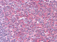 Anti-Lysyl-tRNA synthetase antibody [8G12C1] used in IHC (Paraffin sections) (IHC-P). GTX83186