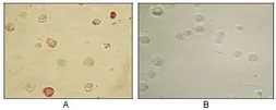 Anti-KSHV ORF45 antibody [2D4A5] used in Immunocytochemistry/ Immunofluorescence (ICC/IF). GTX83236