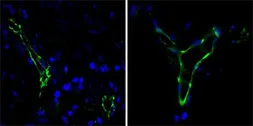 Anti-CD31 antibody [2F7B2] used in IHC (Paraffin sections) (IHC-P). GTX83248