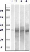 Anti-Rab25 antibody [3F12F3] used in Western Blot (WB). GTX83350