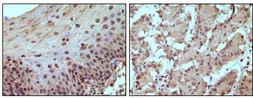 Anti-Rb antibody [7E4B8] used in IHC (Paraffin sections) (IHC-P). GTX83384