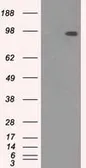 Anti-TYRO3 antibody [9B12] used in Western Blot (WB). GTX83453
