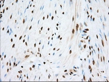 Anti-TACC3 antibody [6F1] used in IHC (Paraffin sections) (IHC-P). GTX83531