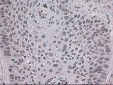 Anti-STAT3 antibody [21E7] used in IHC (Paraffin sections) (IHC-P). GTX83549