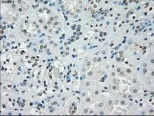 Anti-SSX2 antibody [4D10] used in IHC (Paraffin sections) (IHC-P). GTX83555