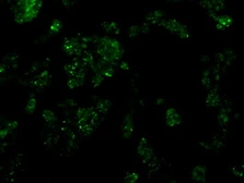 Anti-Serine racemase antibody [9E8] used in Immunocytochemistry/ Immunofluorescence (ICC/IF). GTX83567