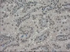 Anti-SLC7A8 antibody [8B12] used in IHC (Paraffin sections) (IHC-P). GTX83620