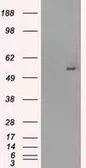 Anti-GLUT5 antibody [9F3] used in Western Blot (WB). GTX83628