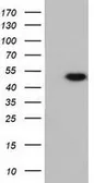 Anti-Ribonuclease Inhibitor antibody [4G4] used in Western Blot (WB). GTX83697