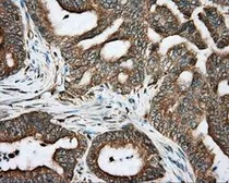 Anti-RDH11 antibody [1B4] used in IHC (Paraffin sections) (IHC-P). GTX83716