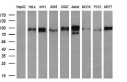 Anti-RALBP1 antibody [1H9] used in Western Blot (WB). GTX83727