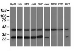 Anti-RABL2A antibody [2G10] used in Western Blot (WB). GTX83737
