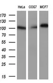 Anti-PROM2 antibody [5E5] used in Western Blot (WB). GTX83797