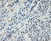 Anti-PKMYT1 antibody [5E1] used in IHC (Paraffin sections) (IHC-P). GTX83877