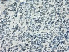 Anti-PDE10A antibody [1C9] used in IHC (Paraffin sections) (IHC-P). GTX83933