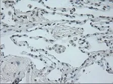Anti-Oncostatin M antibody [2B6] used in IHC (Paraffin sections) (IHC-P). GTX83959