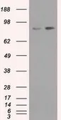 Anti-TrkC antibody [19B8] used in Western Blot (WB). GTX83976