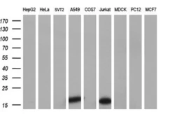 Anti-NME4 antibody [1A5] used in Western Blot (WB). GTX84032