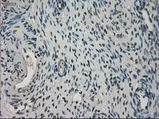 Anti-NEK6 antibody [8G5] used in IHC (Paraffin sections) (IHC-P). GTX84056