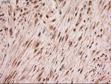 Anti-c-Myc antibody [3F2] used in IHC (Paraffin sections) (IHC-P). GTX84065