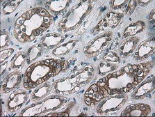 Anti-Cytokeratin 18 antibody [5E8] used in IHC (Paraffin sections) (IHC-P). GTX84255