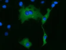 Anti-KLHL2 antibody [6D8] used in Immunocytochemistry/ Immunofluorescence (ICC/IF). GTX84261