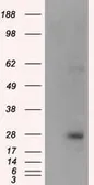 Anti-KCTD5 antibody [3C8] used in Western Blot (WB). GTX84281