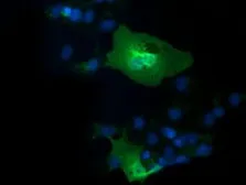 Anti-IL1F6 antibody [1D11] used in Immunocytochemistry/ Immunofluorescence (ICC/IF). GTX84299