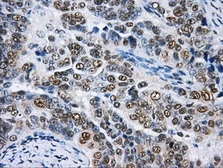 Anti-hnRNP F antibody [5F5] used in IHC (Paraffin sections) (IHC-P). GTX84356