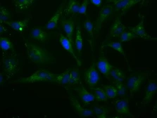 Anti-H6PD antibody [1H6] used in Immunocytochemistry/ Immunofluorescence (ICC/IF). GTX84394
