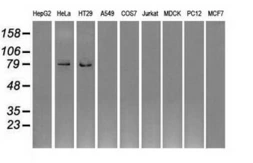 Anti-GBE1 antibody [1D11] used in Western Blot (WB). GTX84452