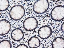 Anti-EPM2AIP1 antibody [1F11] used in IHC (Paraffin sections) (IHC-P). GTX84561