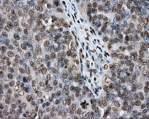 Anti-DAP Kinase 2 antibody [1C5] used in IHC (Paraffin sections) (IHC-P). GTX84631