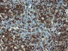 Anti-CD2 antibody [9D1] used in IHC (Paraffin sections) (IHC-P). GTX84725