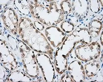 Anti-Rho GDI alpha antibody [1A7] used in IHC (Paraffin sections) (IHC-P). GTX84860
