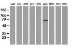 Anti-ARHGAP25 antibody [3G1] used in Western Blot (WB). GTX84863