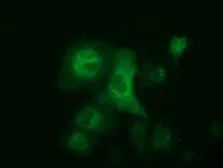 Anti-ALDH1L1 antibody [7G6] used in Immunocytochemistry/ Immunofluorescence (ICC/IF). GTX84894