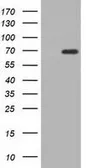 Anti-AK5 antibody [1D5] used in Western Blot (WB). GTX84922