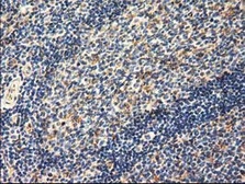 Anti-AK3 antibody [6B7] used in IHC (Paraffin sections) (IHC-P). GTX84929