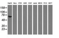 Anti-Alpha fetoprotein / AFP antibody [3G3/2D3] used in Western Blot (WB). GTX84948