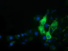 Anti-Alpha fetoprotein / AFP antibody [2A9] used in Immunocytochemistry/ Immunofluorescence (ICC/IF). GTX84954