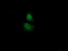 Anti-ADI1 antibody [3H6] used in Immunocytochemistry/ Immunofluorescence (ICC/IF). GTX84958