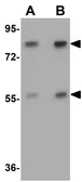 Anti-APC4 antibody used in Western Blot (WB). GTX85006