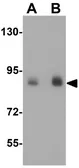 Anti-DCLK1 antibody used in Western Blot (WB). GTX85008