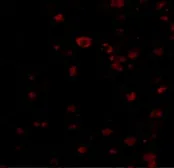 Anti-BRSK1 antibody used in Immunocytochemistry/ Immunofluorescence (ICC/IF). GTX85055