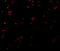 Anti-CTRP2 antibody used in Immunocytochemistry/ Immunofluorescence (ICC/IF). GTX85071