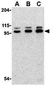Anti-TLR6 antibody used in Western Blot (WB). GTX85074