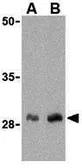 Anti-CTRP1 antibody used in Western Blot (WB). GTX85079